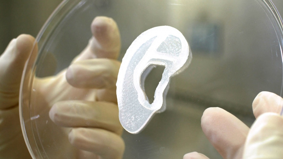 En este momento estás viendo Trasplantan por primera vez una oreja impresa en 3D con células humanas