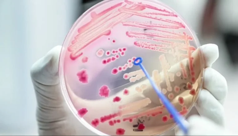 Lee más sobre el artículo Alerta faringitis: Salud advirtió por una bacteria que provocó 16 muertes