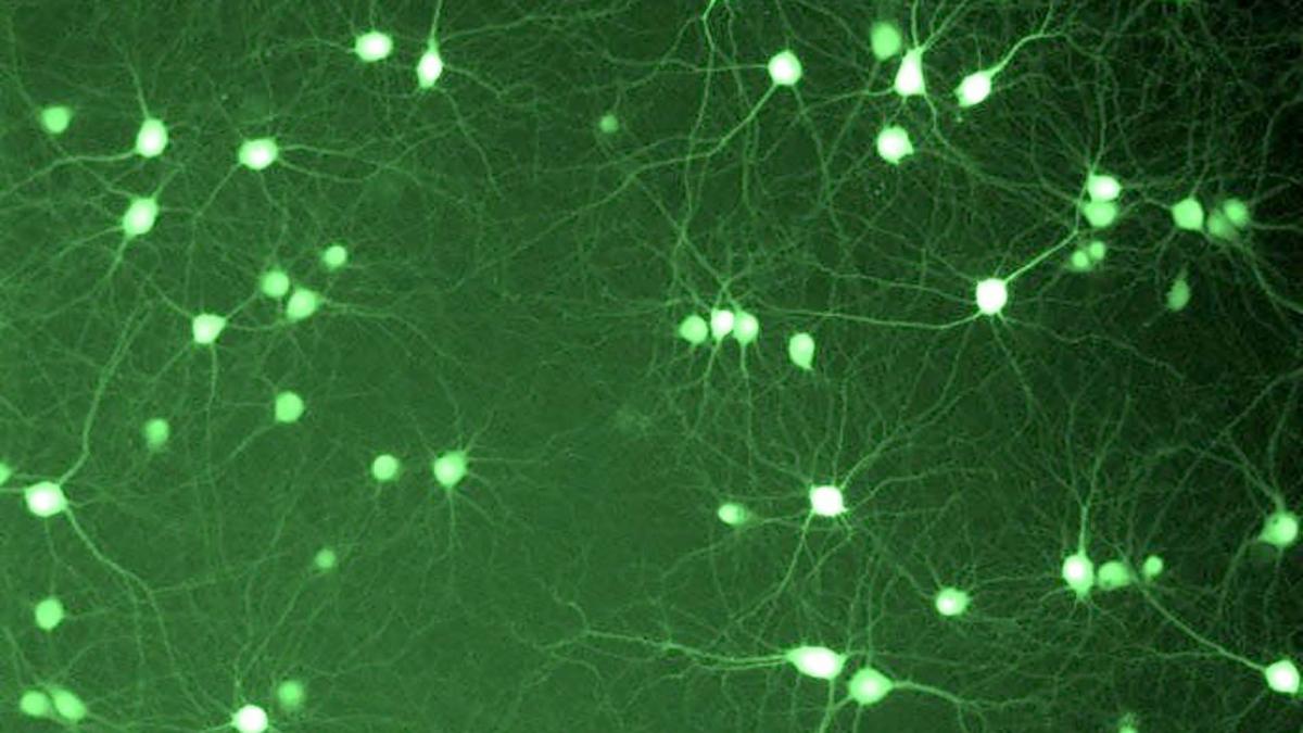 En este momento estás viendo Identifican propiedades de moléculas claves en la regulación de la expresión genética